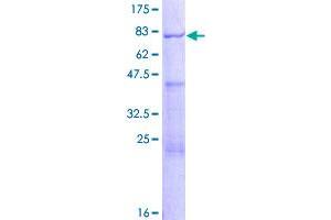 Image no. 1 for Angio-Associated, Migratory Cell Protein (AAMP) (AA 1-434) protein (GST tag) (ABIN1305399)