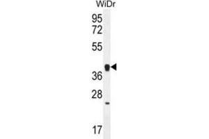 Western Blotting (WB) image for anti-Olfactory Receptor, Family 2, Subfamily T, Member 8 (OR2T8) antibody (ABIN2996544) (OR2T8 anticorps)