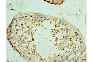 Immunohistochemistry of paraffin-embedded human testis tissue using ABIN7174360 at dilution of 1:100 (USP8 anticorps  (C-Term))