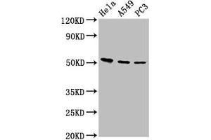 anti-Amyotrophic Lateral Sclerosis 2 (Juvenile) Chromosome Region, Candidate 12 (ALS2CR12) (AA 26-76) antibody