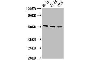 Western Blot Positive WB detected in: Hela whole cell lysate, A549 whole cell lysate, PC-3 whole cell lysate All lanes: ALS2CR12 antibody at 12 μg/mL Secondary Goat polyclonal to rabbit IgG at 1/50000 dilution Predicted band size: 53, 50 kDa Observed band size: 53 kDa (ALS2CR12 anticorps  (AA 26-76))
