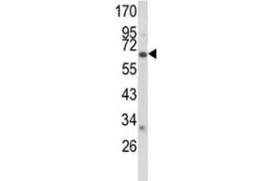 Western blot analysis of CYP2F1 antibody and A2058 lysate.
