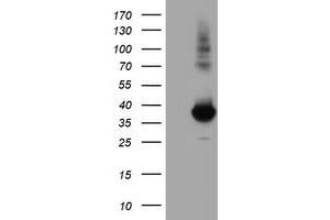 Western Blotting (WB) image for anti-Monoglyceride Lipase (MGLL) antibody (ABIN1499443) (MGLL anticorps)
