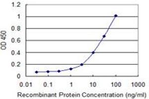 Detection limit for recombinant GST tagged SFMBT1 is 0.