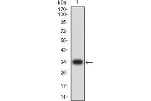 Western blot analysis using CCL4 mAb against human CCL4 (AA: 24-92) recombinant protein. (CCL4 anticorps  (AA 24-92))