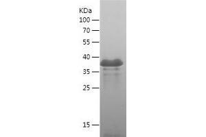 Western Blotting (WB) image for Solute Carrier Family 16 (Monocarboxylic Acid Transporters), Member 3 (SLC16A3) (AA 406-465) protein (His-IF2DI Tag) (ABIN7125153)
