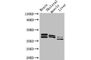 Western Blot Positive WB detected in: Mouse brain tissue, Mouse skeletal muscle tissue, Mouse liver tissue All lanes: ALDOC antibody at 3 μg/mL Secondary Goat polyclonal to rabbit IgG at 1/50000 dilution Predicted band size: 40 kDa Observed band size: 40, 36, 42 kDa (ALDOC anticorps  (AA 190-354))