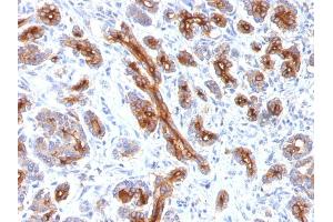 Formalin-fixed, paraffin-embedded human Pancreas stained with CFTR Monoclonal Antibody (CFTR/1341).