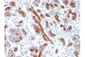 Formalin-fixed, paraffin-embedded human Pancreas stained with CFTR Monoclonal Antibody (CFTR/1341). (CFTR anticorps)