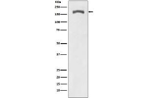 Western blot analysis of Phospho-PDGF Receptor beta (Y740) expression in NIH 3T3 treated with PDGF.
