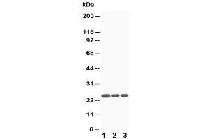 Western blot testing of SOCS3 antibody and Lane 1:  Jurkat (SOCS3 anticorps  (Middle Region))