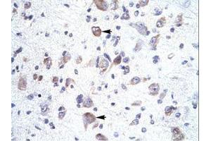 anti-Homeobox A1 (HOXA1) (C-Term) antibody