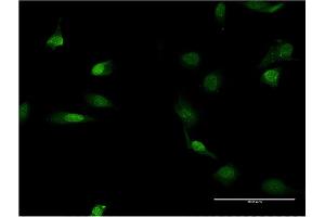 Immunofluorescence of monoclonal antibody to LMNB1 on HeLa cell.