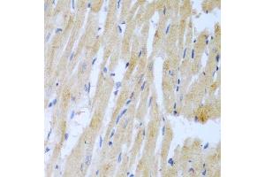 Immunohistochemistry of paraffin-embedded rat heart using UBE2L3 antibody. (UBE2L3 anticorps  (AA 73-212))