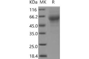Western Blotting (WB) image for HEPACAM Family Member 2 (HEPACAM2) protein (His tag) (ABIN7321174)