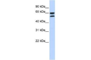 WB Suggested Anti-ACOT11 Antibody Titration: 0. (ACOT11 anticorps  (Middle Region))