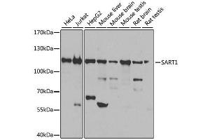 Western blot analysis of extracts of various cell lines, using SART1 antibody. (SART1 anticorps  (AA 1-255))