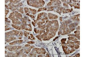 anti-Carboxypeptidase B1 (Tissue) (CPB1) (AA 14-417) antibody