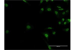 Immunofluorescence of monoclonal antibody to ADNP on HeLa cell. (ADNP anticorps  (AA 1018-1102))