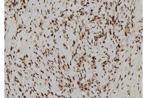 ABIN6278399 at 1/100 staining Human gastric tissue by IHC-P.