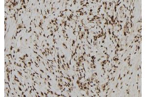 ABIN6278399 at 1/100 staining Human gastric tissue by IHC-P. (RAE1 anticorps  (C-Term))