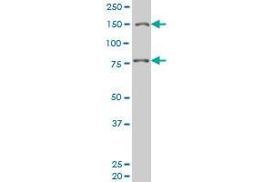 LRRFIP1 monoclonal antibody (M08), clone 3E1 Western Blot analysis of LRRFIP1 expression in Hela S3 NE . (LRRFIP1 anticorps  (AA 675-784))