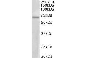 ABIN5539657 (1µg/ml) staining of MCF7 lysate (35µg protein in RIPA buffer). (PRMT3 anticorps  (AA 468-421))