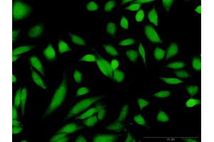 Immunofluorescence of purified MaxPab antibody to GCK on HeLa cell.