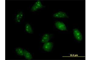 Immunofluorescence of purified MaxPab antibody to UPF3A on HeLa cell. (UPF3A anticorps  (AA 1-443))