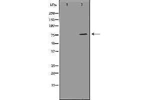 Western blot analysis of MDA MB 361 cell lysate, using ATF6 Antibody. (ATF6 anticorps  (Internal Region))