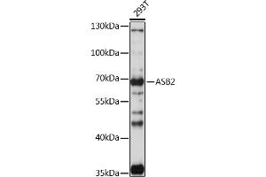 Western blot analysis of extracts of 293T cells, using  antibody (ABIN7265612) at 1:1000 dilution. (ASB2 anticorps  (AA 448-587))