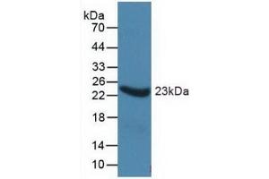 Detection of Recombinant a1AGP, Human using Monoclonal Antibody to Alpha-1-Acid Glycoprotein (a1AGP)