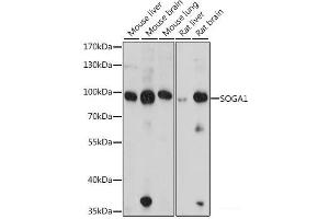 Western blot analysis of extracts of various cell lines using SOGA1 Polyclonal Antibody at dilution of 1:1000. (SOGA1 anticorps)