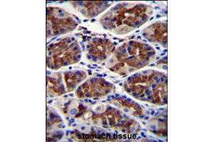 EPHX3 Antibody immunohistochemistry analysis in formalin fixed and paraffin embedded human stomach tissue followed by peroxidase conjugation of the secondary antibody and DAB staining. (ABHD9 anticorps  (C-Term))
