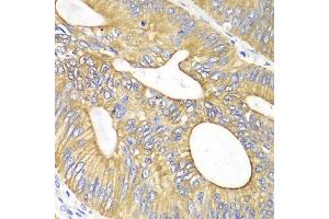 Immunohistochemistry (IHC) image for anti-Vascular Endothelial Growth Factor B (VEGFB) (AA 100-200) antibody (ABIN3023000)