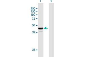 Western Blot analysis of NAPRT1 expression in transfected 293T cell line by NAPRT1 MaxPab polyclonal antibody. (NAPRT1 anticorps  (AA 1-466))