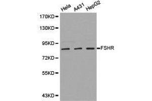 Western Blotting (WB) image for anti-Follicle Stimulating Hormone Receptor (FSHR) antibody (ABIN1872742) (FSHR anticorps)