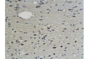 Formalin-fixed and paraffin embedded mouse brain labeled with Anti-Sphingomyelin Synthase 1 Polyclonal Antibody, Unconjugated  followed by conjugation to the secondary antibody and DAB staining