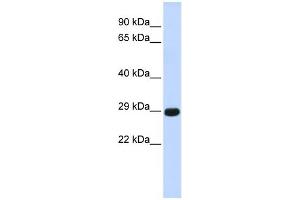 WB Suggested Anti-CTRB1 Antibody Titration:  0. (CTRB1 anticorps  (Middle Region))