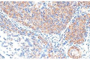 Immunohistochemistry of paraffin-embedded Rat ovary using TIMP2 Polyclonal Antibody at dilution of 1:100 (40x lens). (TIMP2 anticorps)