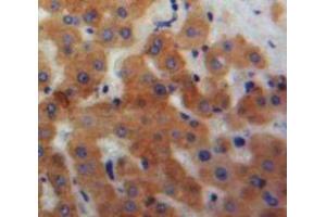 IHC-P analysis of Liver tissue, with DAB staining. (Ficolin 2 anticorps  (AA 97-254))