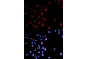 Immunofluorescence analysis of U2OS cell using Phospho-MYC-S62 antibody. (c-MYC anticorps  (pSer62))