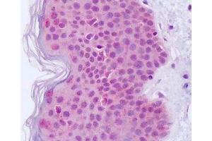 Anti-EGFR antibody IHC staining of human skin. (EGFR anticorps)