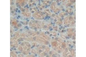 Used in DAB staining on fromalin fixed paraffin- embedded Kidney tissue (SNX18 anticorps  (AA 411-614))
