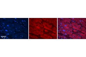 Rabbit Anti-CES2 Antibody    Formalin Fixed Paraffin Embedded Tissue: Human Adult heart  Observed Staining: Cytoplasmic Primary Antibody Concentration: 1:100 Secondary Antibody: Donkey anti-Rabbit-Cy2/3 Secondary Antibody Concentration: 1:200 Magnification: 20X Exposure Time: 0. (CES2 anticorps  (C-Term))