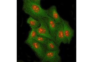 IF analysis of RRP8 and Tubulin beta using anti-RRP8 antibody (ABIN7600459) and anti-Tubulin beta antibody (ABIN7602744).