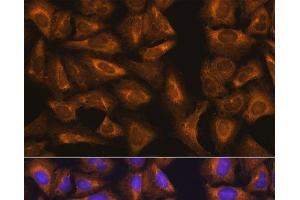Immunofluorescence analysis of U-2 OS cells using RPL17 Polyclonal Antibody at dilution of 1:100. (RPL17 anticorps)