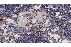 ABIN6266817 at 1/100 staining human Lymph node tissue sections by IHC-P. (NT5C3 anticorps  (N-Term))