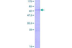 Image no. 1 for Nth Endonuclease III-Like 1 (NTHL1) (AA 1-304) protein (GST tag) (ABIN1313111)