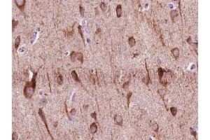 ABIN6266954 at 1/100 staining human brain tissue sections by IHC-P. (ZNF287 anticorps)